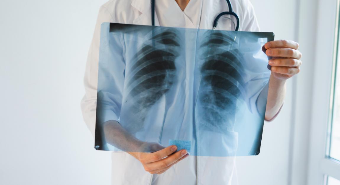 Physician holding chest x-ray