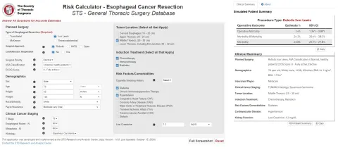 esophageal cancer